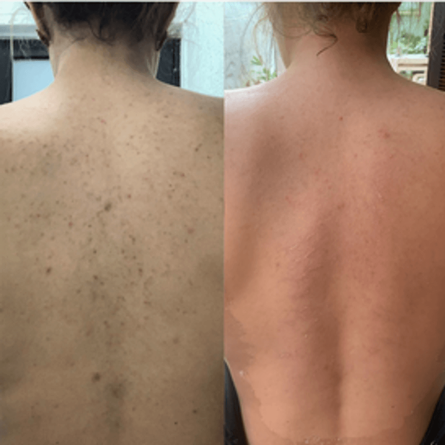 Peeling Mar Morto (Corporal)