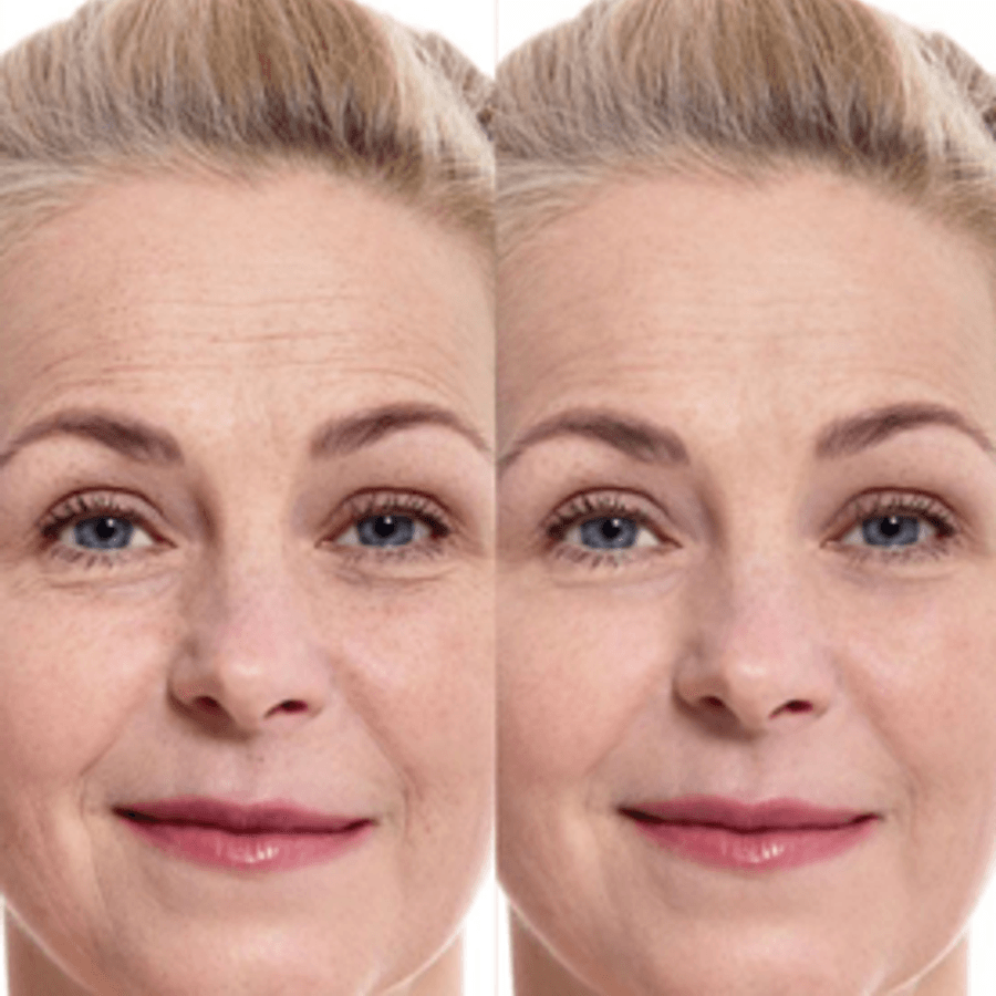Skinbooster