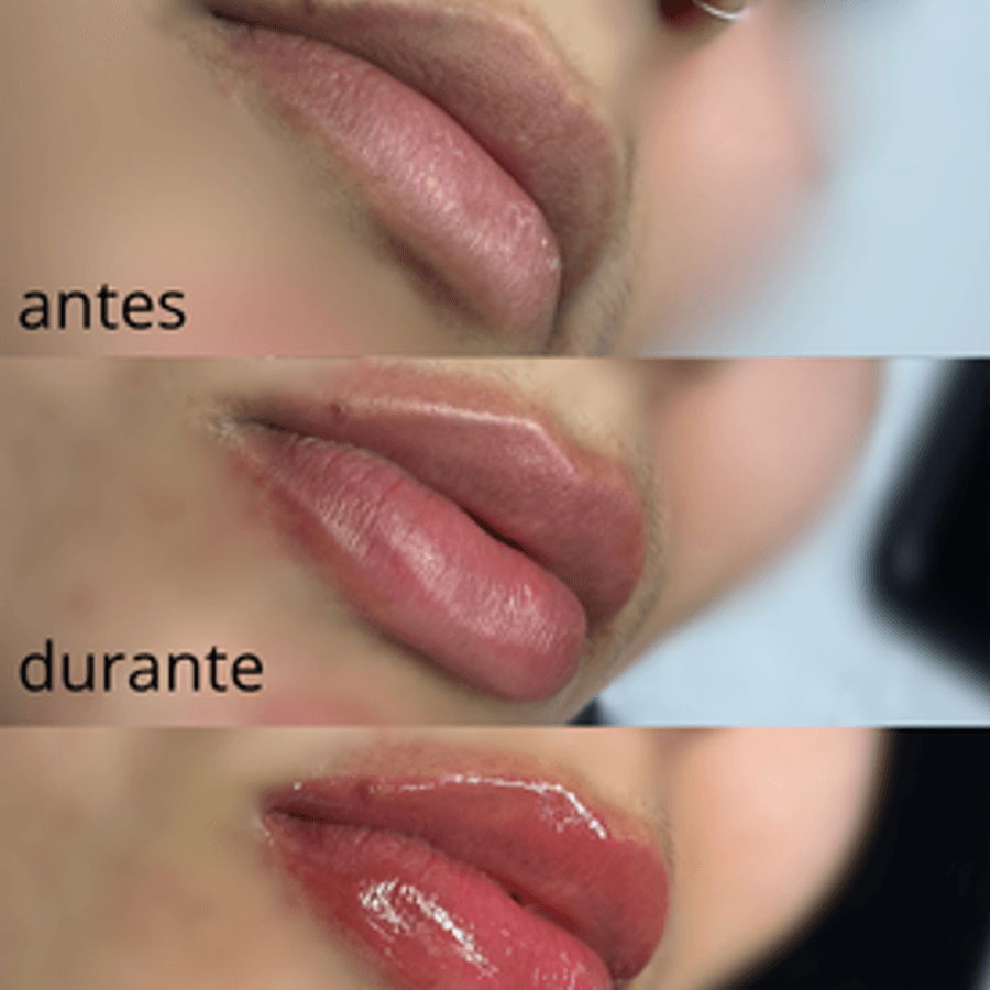 Hydra Gloss Lips